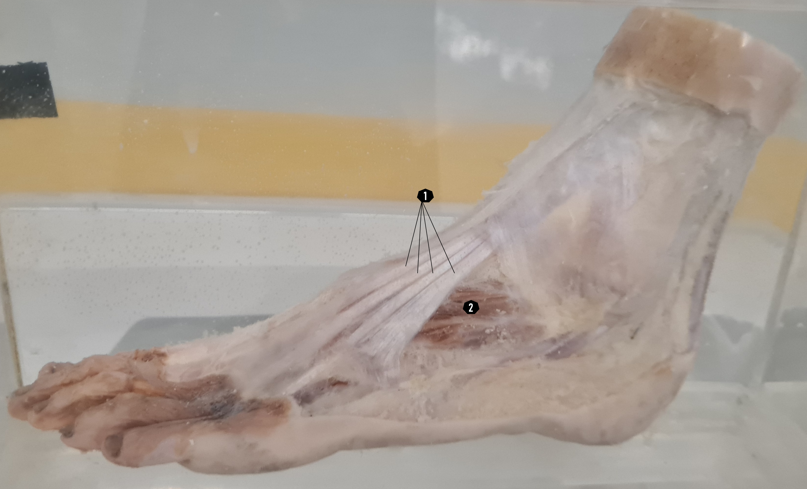 Kaki (struktur dalam, tampak punggung kaki dan lateral)