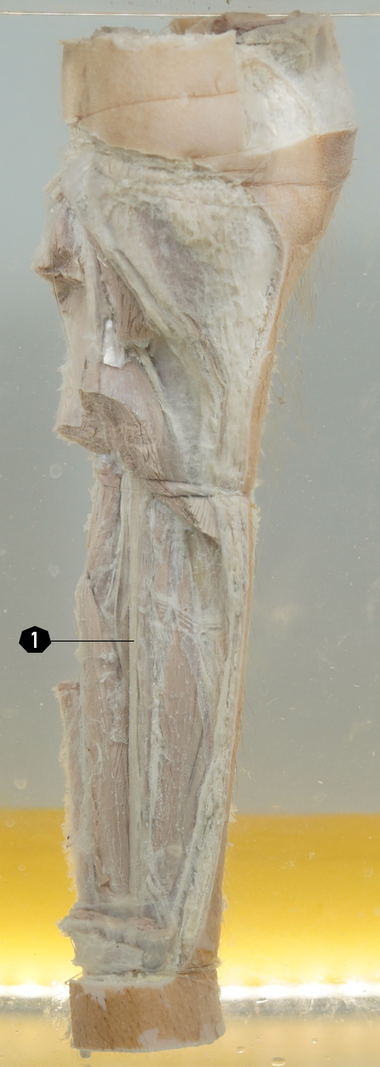 Tungkai bawah kanan (stuktur dalam, tampak posterior)
