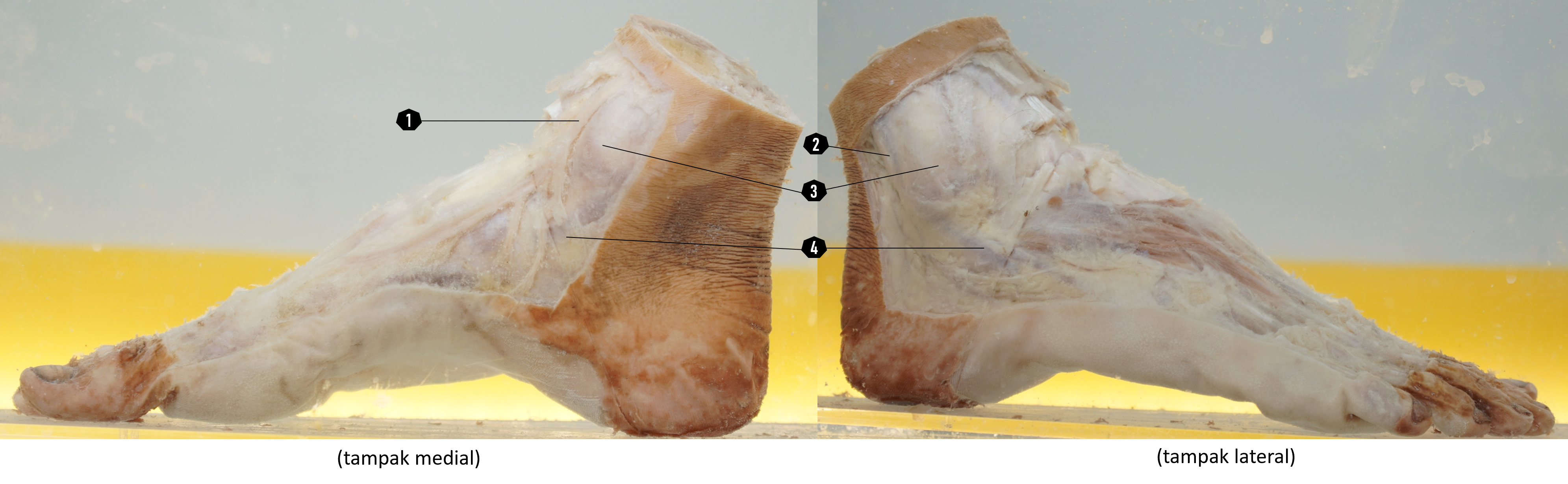 Kaki (struktur dalam, tampak lateral dan medial)