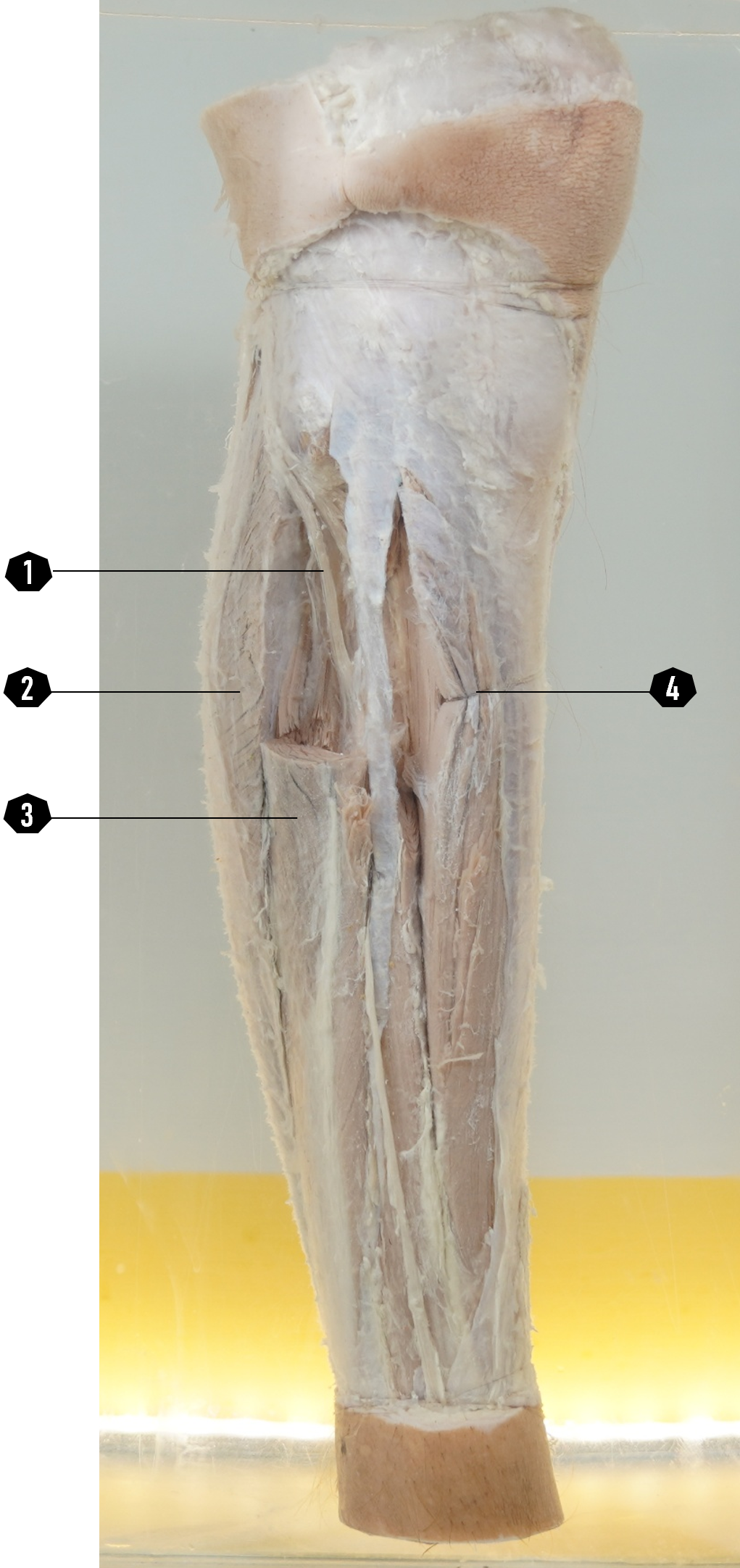 Tungkai bawah kanan (stuktur permukaan, tampak lateral)